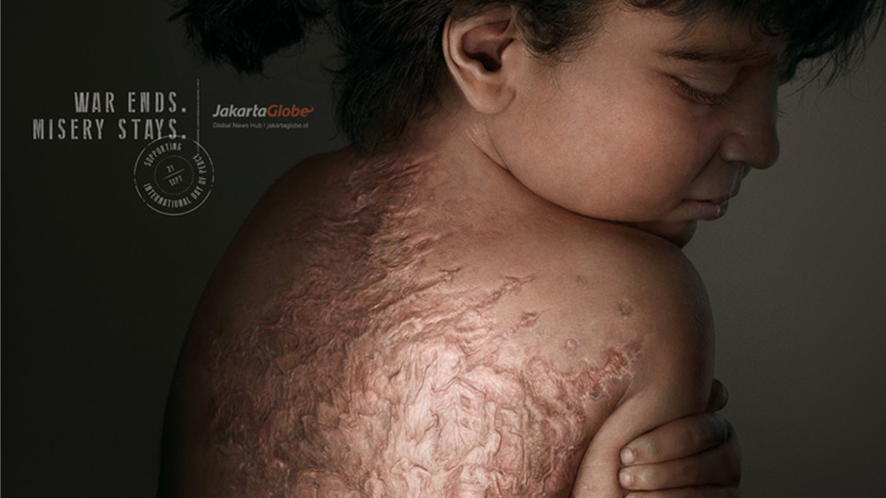 Scars of Miserry Girl